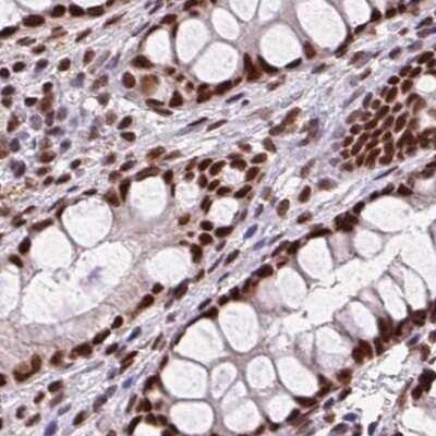 Immunohistochemistry-Paraffin: ZNF207 Antibody [NBP2-39010]