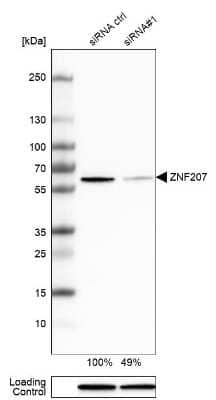 Western Blot: ZNF207 Antibody [NBP1-89550]