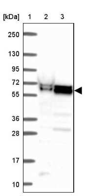 Western Blot: ZNF207 Antibody [NBP2-39010]