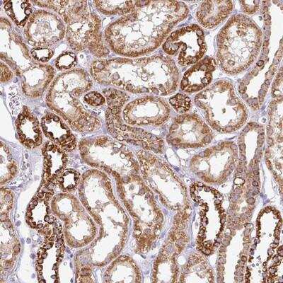 Immunohistochemistry: ZNF211 Antibody [NBP2-13558]