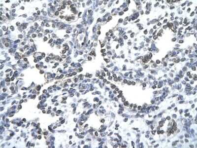 Immunohistochemistry-Paraffin: ZNF212 Antibody [NBP2-88655]