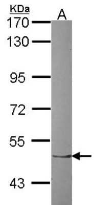 Western Blot: ZNF212 Antibody [NBP2-20975]