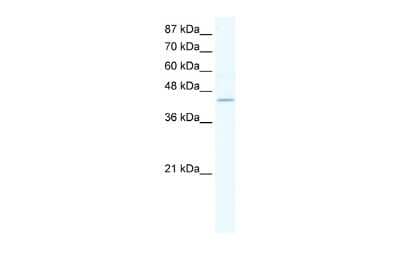 Western Blot: ZNF212 Antibody [NBP2-88654]