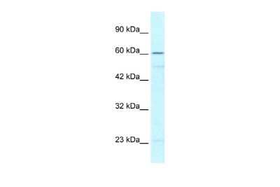 Western Blot: ZNF212 Antibody [NBP2-88655]