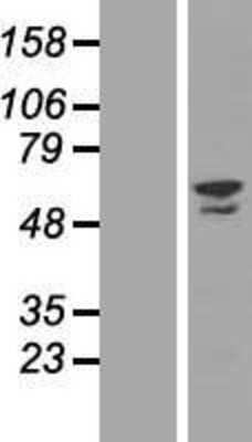 Western Blot: ZNF212 Overexpression Lysate [NBL1-18086]