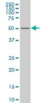 Western Blot: ZNF213 Antibody (3D3) [H00007760-M02]