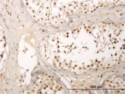 Immunohistochemistry-Paraffin: ZNF213 Antibody (5D7) [H00007760-M01]