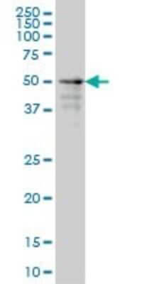 Western Blot: ZNF213 Antibody (5D7) [H00007760-M01]