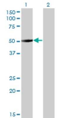 Western Blot: ZNF213 Antibody (5D7) [H00007760-M01]