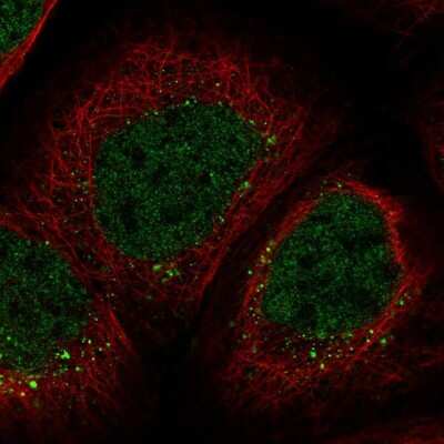 Immunocytochemistry/ Immunofluorescence: ZNF213 Antibody [NBP2-58325]