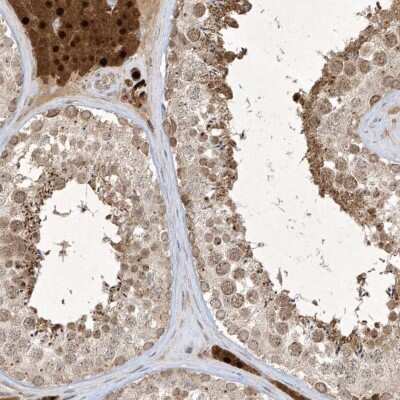 Immunohistochemistry-Paraffin: ZNF213 Antibody [NBP1-84386]