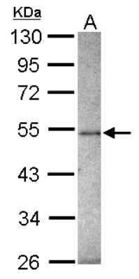 Western Blot: ZNF213 Antibody [NBP2-20976]