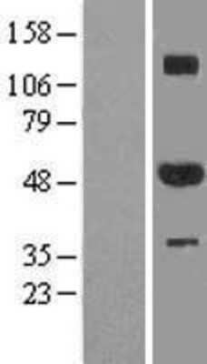 Western Blot: ZNF213 Overexpression Lysate [NBL1-18087]