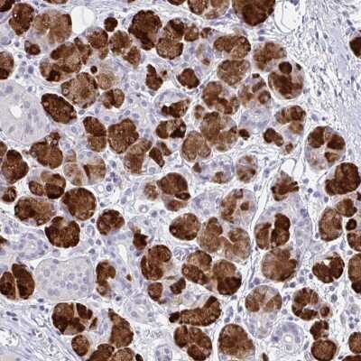 Immunohistochemistry: ZNF214 Antibody [NBP2-31602]