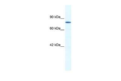 Western Blot: ZNF214 Antibody [NBP2-86454]