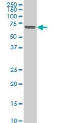 Western Blot: ZNF215 Antibody (1E4) [H00007762-M02]