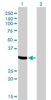 Western Blot: ZNF215 Antibody (2C11) [H00007762-M01]