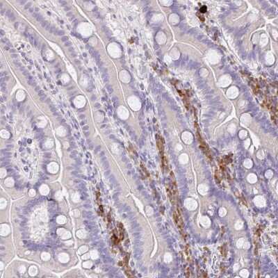 Immunohistochemistry: ZNF215 Antibody [NBP2-48992]