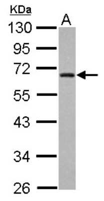 Western Blot: ZNF215 Antibody [NBP2-20977]