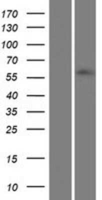 Western Blot: ZNF215 Overexpression Lysate [NBP2-07431]