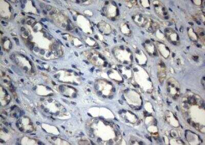 Immunohistochemistry-Paraffin: ZNF217 Antibody (OTI3G5) [NBP2-46424]