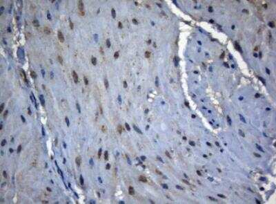Immunohistochemistry-Paraffin: ZNF217 Antibody (OTI3G5) [NBP2-46424]
