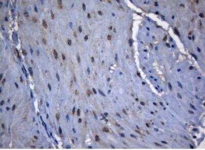 Immunohistochemistry-Paraffin: ZNF217 Antibody (OTI3G5) [NBP2-46424]