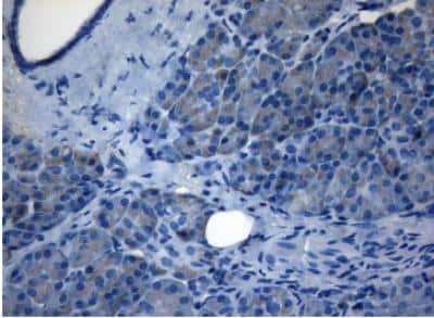 Immunohistochemistry-Paraffin: ZNF217 Antibody (OTI3G5) [NBP2-46424]