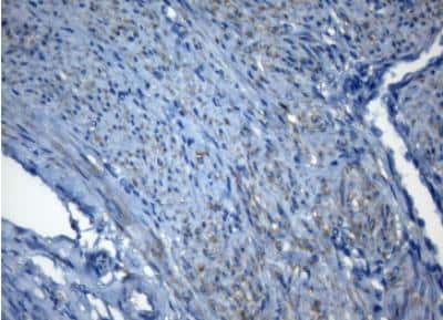 Immunohistochemistry-Paraffin: ZNF217 Antibody (OTI3G5) [NBP2-46424]