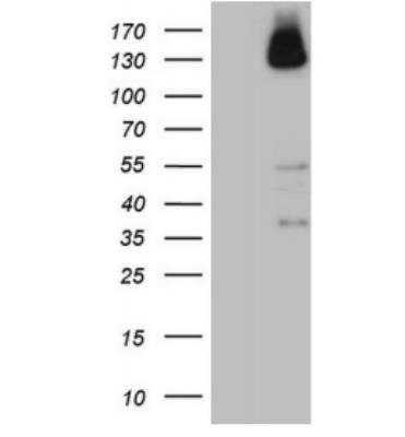 Western Blot: ZNF217 Antibody (OTI3G5) [NBP2-46424]