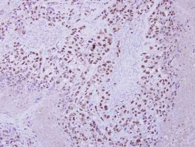 Immunohistochemistry-Paraffin: ZNF217 Antibody [NBP2-20978]