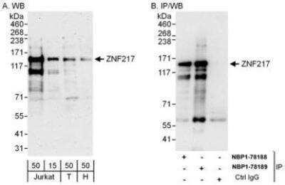 Western Blot: ZNF217 Antibody [NBP1-78189]