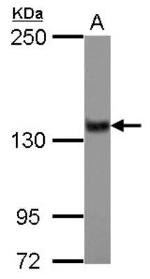 Western Blot: ZNF217 Antibody [NBP2-20978]