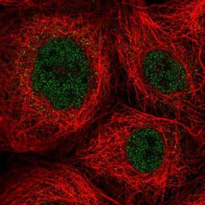 Immunocytochemistry/ Immunofluorescence: ZNF22 Antibody [NBP2-58405]