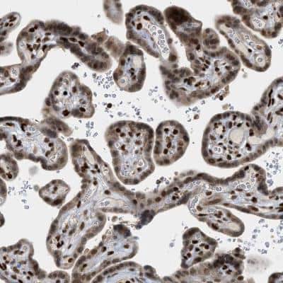 Immunohistochemistry-Paraffin: ZNF22 Antibody [NBP1-81739]