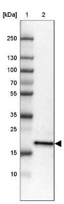 Western Blot: ZNF22 Antibody [NBP1-81739]