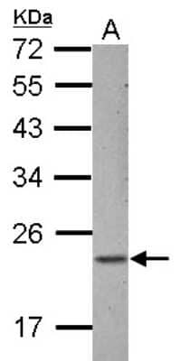 Western Blot: ZNF22 Antibody [NBP2-20979]