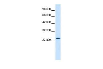 Western Blot: ZNF22 Antibody [NBP2-88656]