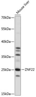 Western Blot: ZNF22 AntibodyAzide and BSA Free [NBP2-93870]