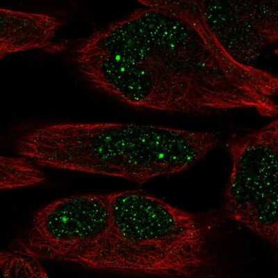 Immunocytochemistry/ Immunofluorescence: ZNF221 Antibody [NBP2-31768]