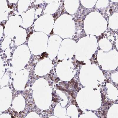 Immunohistochemistry-Paraffin: ZNF221 Antibody [NBP2-31768]