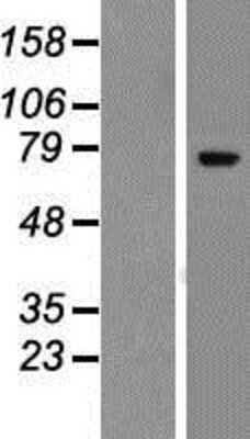 Western Blot: ZNF221 Overexpression Lysate [NBP2-07422]