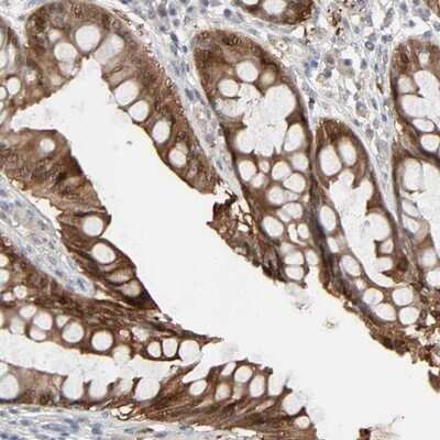 Immunohistochemistry-Paraffin: ZNF222 Antibody [NBP1-86148]