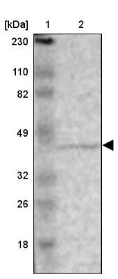 Western Blot: ZNF222 Antibody [NBP1-86148]