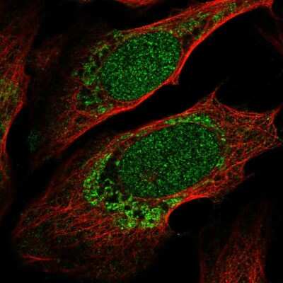 Immunocytochemistry/ Immunofluorescence: ZNF223 Antibody [NBP2-56382]