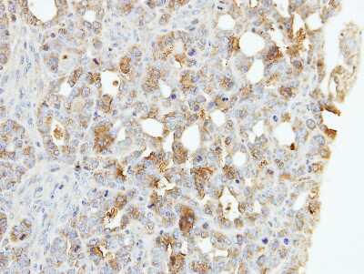 Immunohistochemistry-Paraffin: ZNF223 Antibody [NBP1-33094]