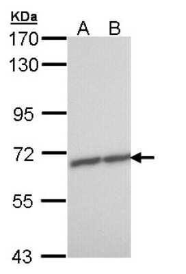 Western Blot: ZNF223 Antibody [NBP1-33094]