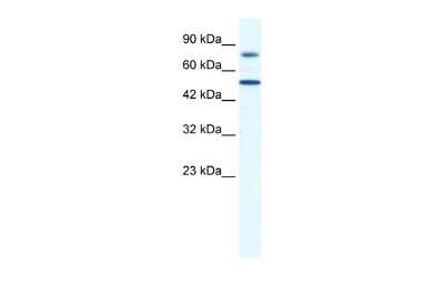 Western Blot: ZNF223 Antibody [NBP2-86458]