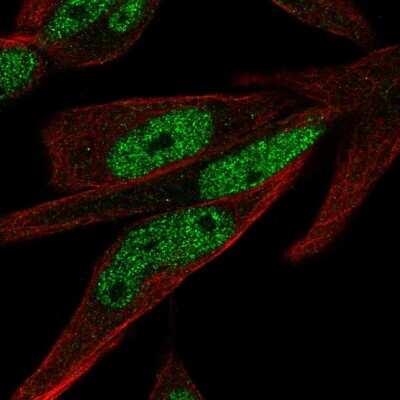 Immunocytochemistry/ Immunofluorescence: ZNF225 Antibody [NBP2-58019]