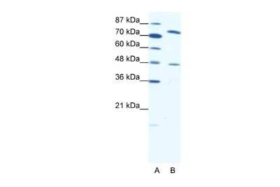 Western Blot: ZNF225 Antibody [NBP2-83836]